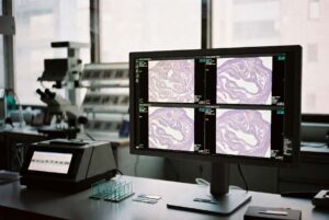 PRISM2 hyödyntää tekoälyä syöpädiagnostiikassa – uusi malli analysoi kokonaisia kudosnäytteitä